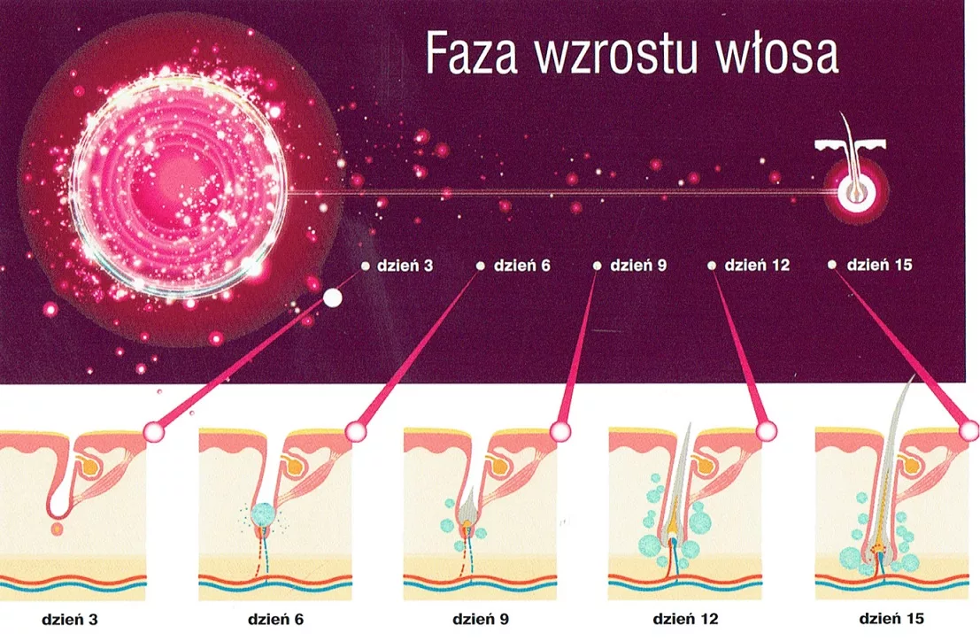 Schemat przedstawiający fazy wzrostu włosa w dniach 3, 6, 9, 12 i 15 po zabiegu z zastosowaniem preparatu Dr.CYJ Hair Filler, ukazujący proces aktywacji mieszków włosowych i odrastania włosów.