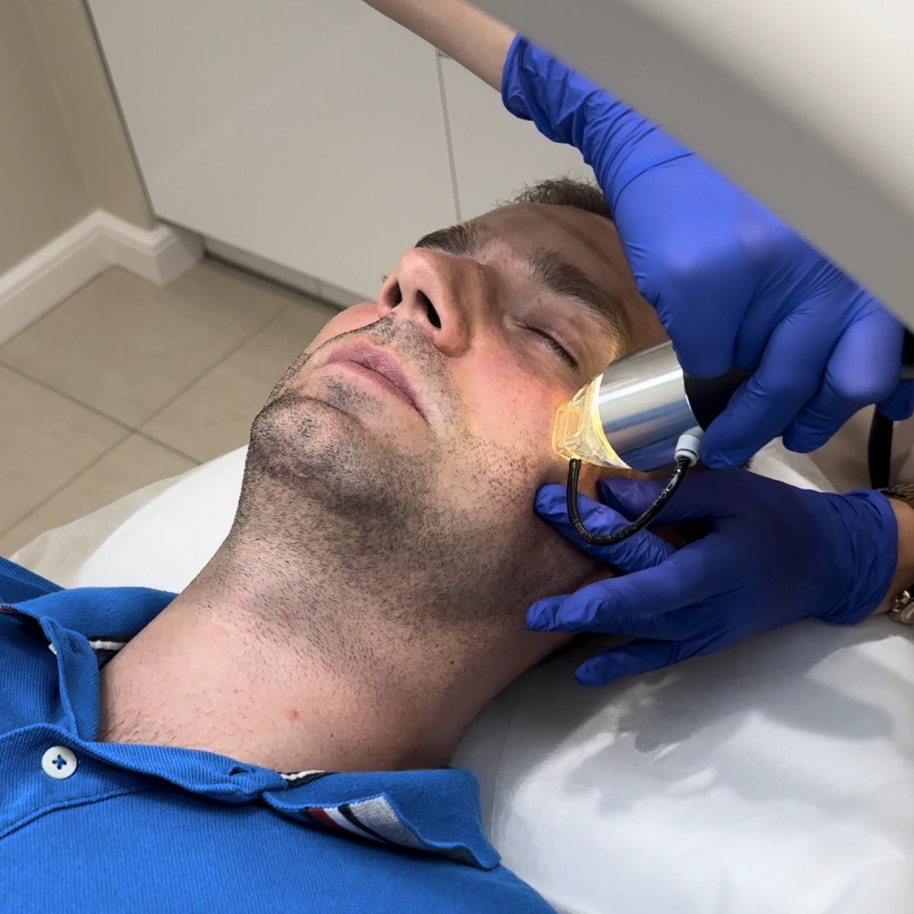 Zabieg Radiofrekwencji Mikroigłowej w salonie kosmetycznym Prestige Laser we wrocławiu