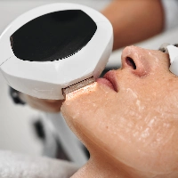 zbliżenie na twarz pacjentki podczas zabiegu laserowego usuwania przebarwień w Prestige Laser Kosmetologia Estetyczna Wrocław