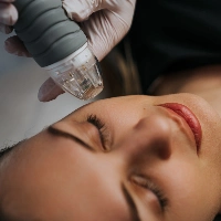 zbliżenie na twarz pacjentki podczas zabiegu radiofrekwencji mikroigłowej w Prestige Laser Kosmetologia Estetyczna Wrocław