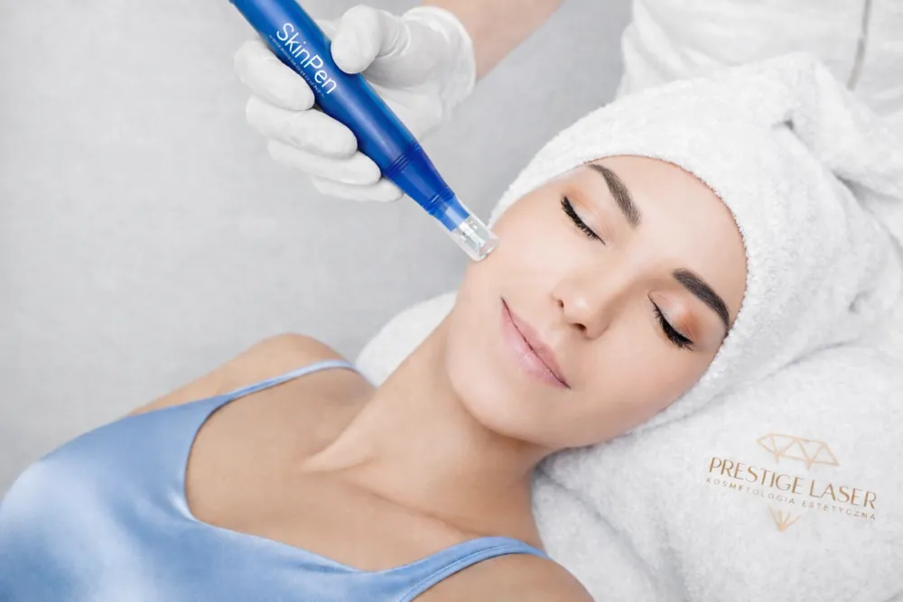 Zabieg mezoterapii mikroigłowej SkinPen wykonywany na twarzy klientki przez specjalistę w gabinecie kosmetologicznym Prestige Laser we Wrocławiu.